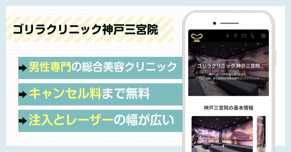 ゴリラクリニック神戸三宮院の特徴まとめ