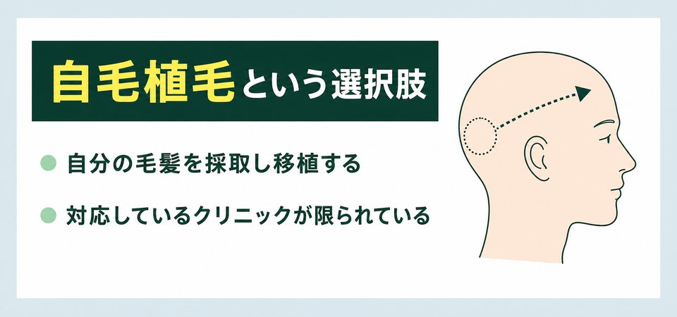 神戸の女性の薄毛治療：その他の治療法