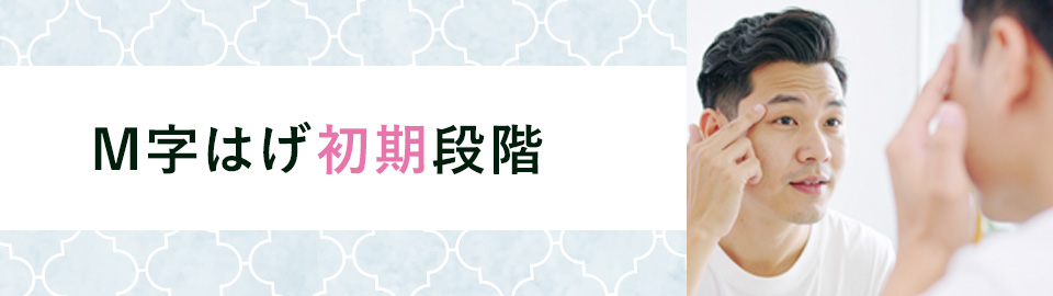 M字はげ初期段階