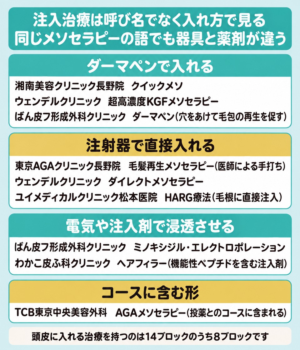 長野の注入治療の呼び名をダーマペンと注射器と浸透とコースの4つの入れ方に仕分けた図