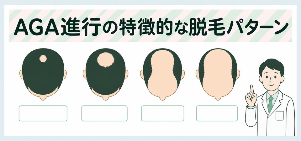 高島分類のイラスト