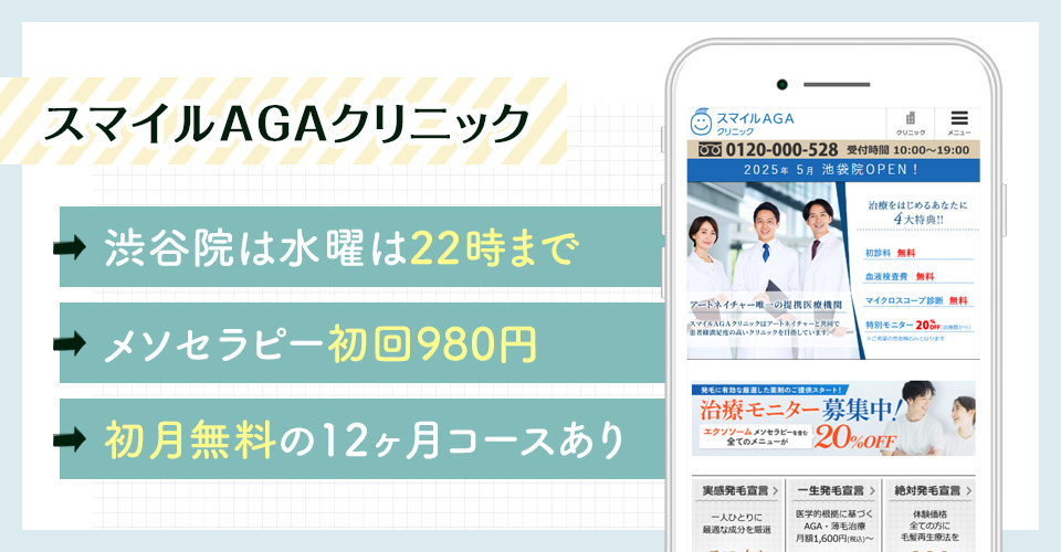 スマイルAGAクリニックのAGA治療ポイントまとめバナー