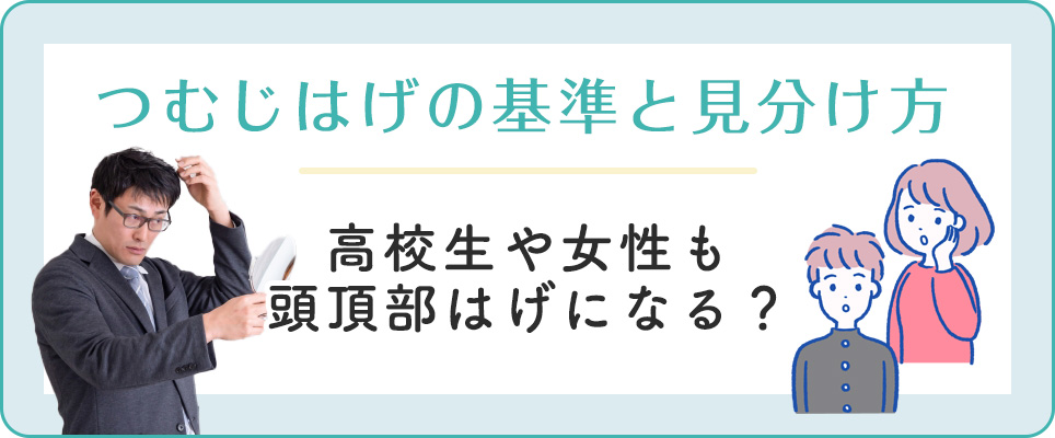 つむじハゲの基準・見分け方。高校生・女性もはげる？