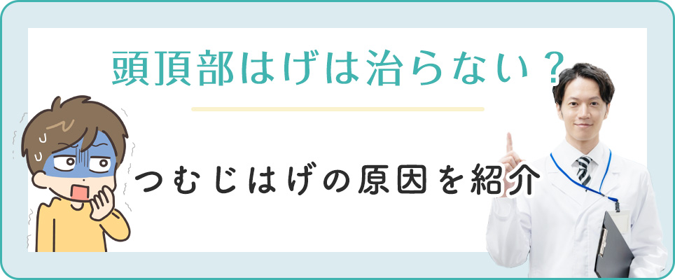 つむじはげの原因と頭頂部ハゲは治らないのか
