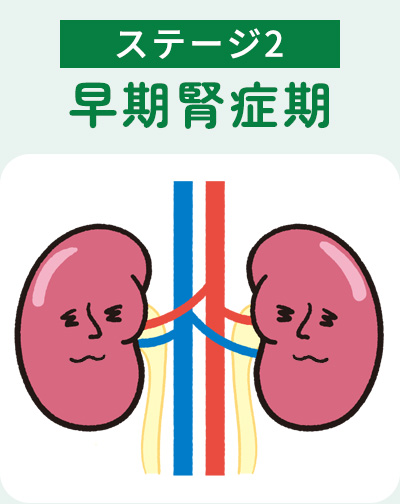ステージ2早期腎症期