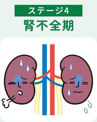 ステージ4腎不全期