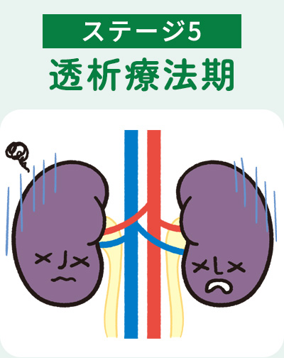 ステージ5透析療法期