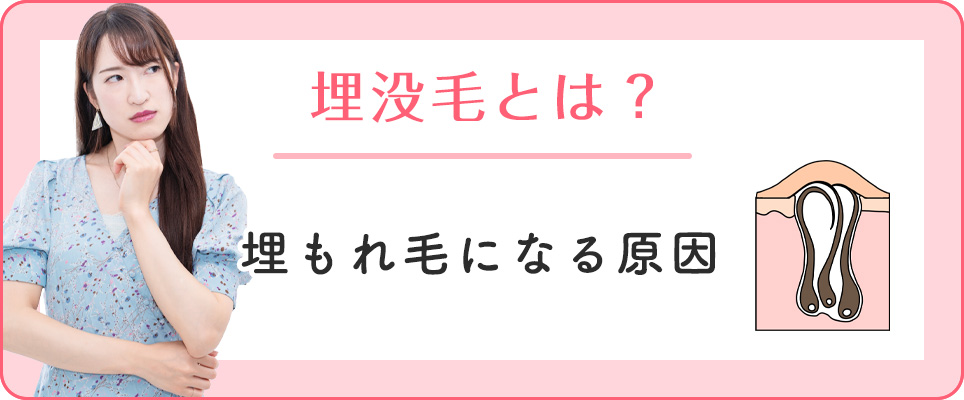 埋もれ毛の原因は？