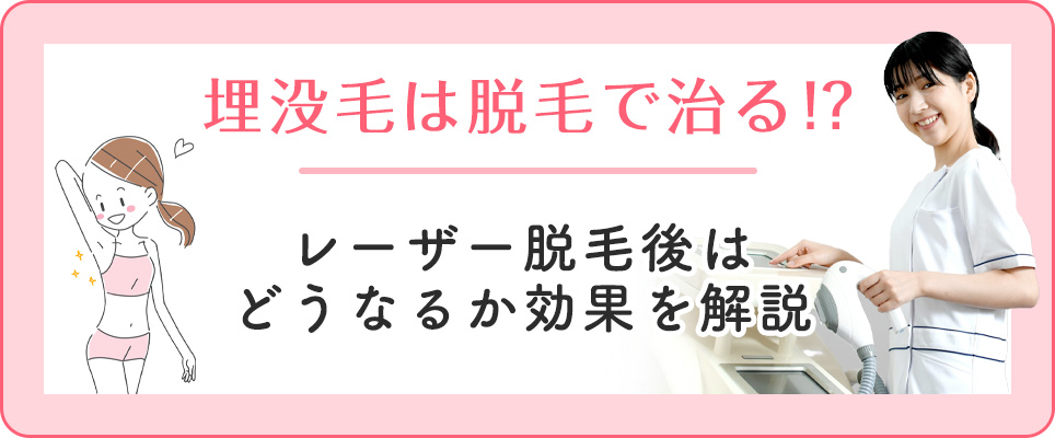埋没毛のレーザー脱毛後は？