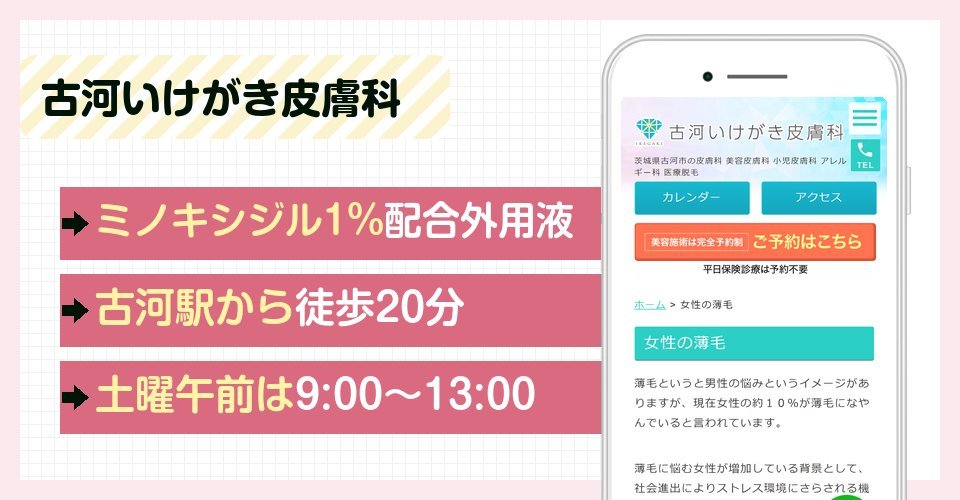 古河いけがき皮膚科の特徴まとめ