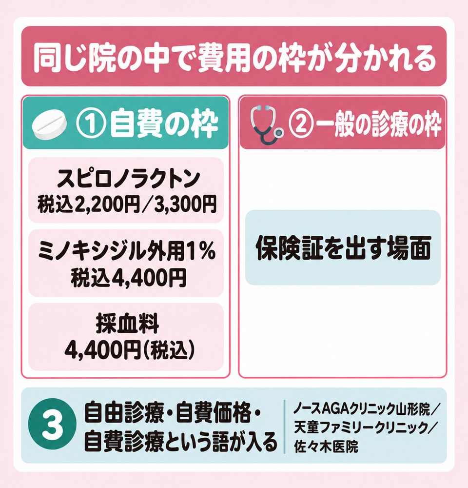 図解: 「同じ院の中で費用の枠が分かれる」。中央に院の建物アイコンを1つ置き、そこから左右2本に分岐させる。左＝番号①「自費の枠」薬アイコン＋チップ「スピロノラクトン 税込2,200円／3,300円」「ミノキシジル外用1％ 税込4,400円」「採血料 4,400円(税込)」、右＝番号②「一般の診療の枠」聴診器アイコン＋チップ「保険証を出す場面」。下段に番号③として「自由診療・自費価格・自費診療という語が入る」の帯を置き、記事の表にある院名(ノースAGAクリニック山形院／天童ファミリークリニック／佐々木医院)を小さく添える。上下に箱を積むだけの図にしない