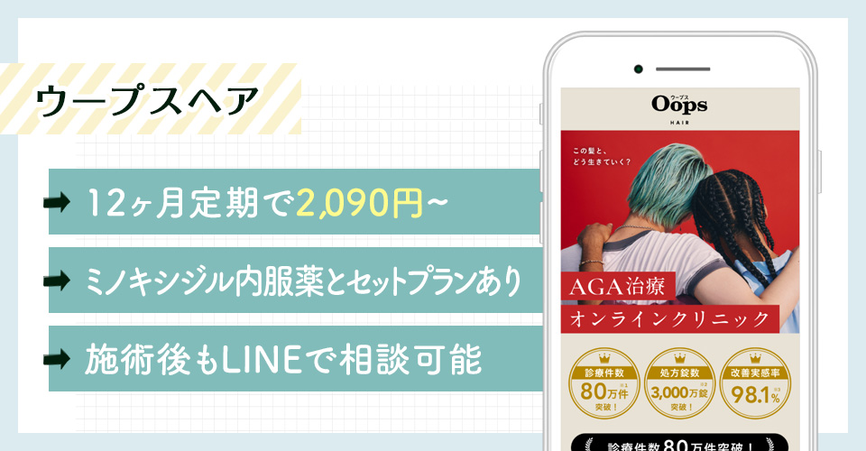 Oops HAIR(ウープスヘア)のおすすめポイントまとめバナー