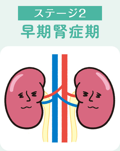 ステージ2早期腎症期