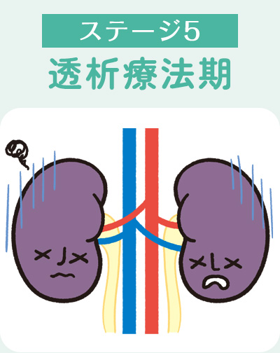 ステージ5透析療法期